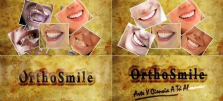 牙齿整形医院宣传AE广告模板