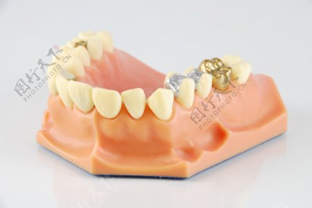 牙科模型不同的处理