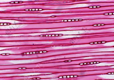 紫红色带状细胞晶晶