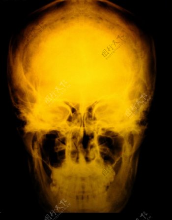 颅骨人头骨X光图片