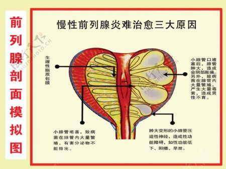 前列腺剖面模拟图图片