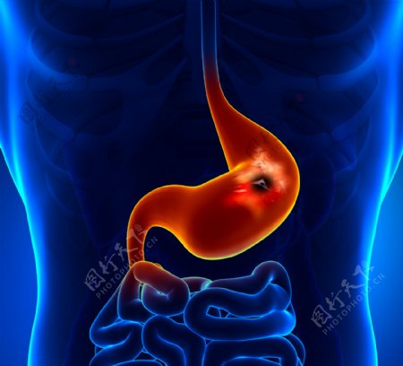 人体胃器官图片